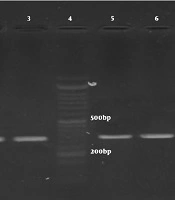 Jundishapur Journal of Microbiology 