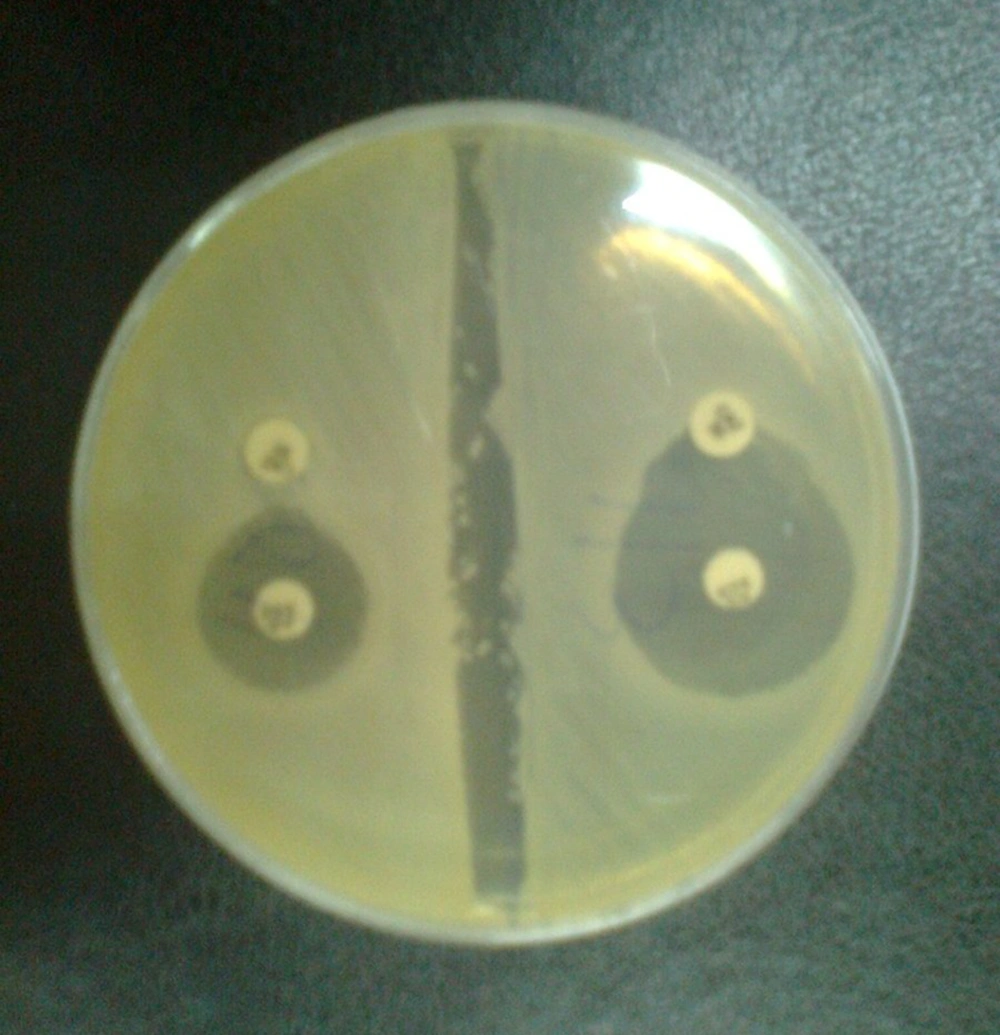 Confirmatory Test for Detection of Extended-spectrum β-lactamase Confirmatory Test for Detection of Extended-spectrum β-lactamase