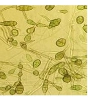 Jundishapur Journal of Health Sciences 