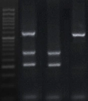 Gene, Cell and Tissue