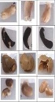 <i>In Vivo</i> Therapeutic Effects of Four Synthesized Antileishmanial Nanodrugs in the Treatment of Leishmaniasis