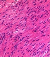 Iranian Journal of Pediatrics