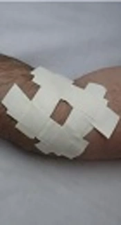 The Immediate Effect of Taping and Counterforce Brace on Pain and Grip Strength in Patients with Tennis Elbow