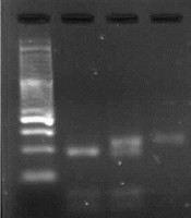 Jundishapur J Microbiol