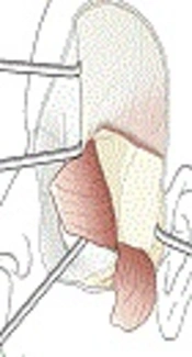 Surgery of Lateral Skull Base, AO Surgery Reference