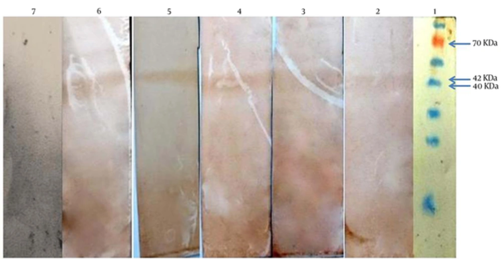 Western Blot Analysis of Recombinant UreB: Line 1, Protein Marker (Fermentas); Line 2, 3, 4, 5 and 6, Serum of Patients with H. Pylori Infection (Positive); and Line 7, Serum of the Negative Control Western Blot Analysis of Recombinant UreB: Line 1, Protein Marker (Fermentas); Line 2, 3, 4, 5 and 6, Serum of Patients with H. Pylori Infection (Positive); and Line 7, Serum of the Negative Control