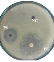 Jundishapur J Microbiol