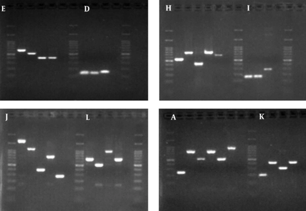 Gel electrophoresis of PCR products obtained from 8 VNTR loci (E, D, H, I, J, L, A, K) on CTX-M-1-producing <i>Klebsiella pneumoniae</i> Gel electrophoresis of PCR products obtained from 8 VNTR loci (E, D, H, I, J, L, A, K) on CTX-M-1-producing <i>Klebsiella pneumoniae</i>