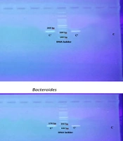 Jundishapur J Microbiol