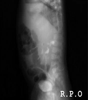Nephro-Urology Monthly