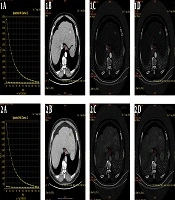Iranian Journal of Radiology