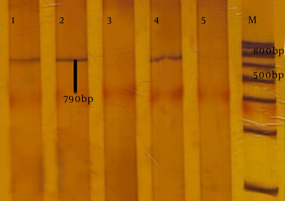 Polyacrylamide Gel Electrophoresis (PAGE) of Products of <i>Pseudomonas aeruginosa</i> KPC Gene, Amplified by the Polymerase Chain Reaction (PCR) Lane M is the marker (DNA ladder, 100bp); lanes 1, 2 and 4, are amplified products of KPC gene in <i>P. aeruginosa</i>, isolated from hospital samples. Lane 5, is the amplified product of the negative control <i>K. pneumoniae</i> lacking the KPC gene. Lane 3, the amplified product of the KPC gene in <i>P. aeruginosa</i> lacking the KPC gene.