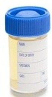 Evaluation of the Relationship Between Clinical Symptoms and Isolation of Fastidious Bacteria in Urine Samples of Elderly Females