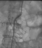 Int J Cardiovasc Pract