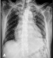 Int J Endocrinol Metab