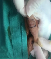 J Skin Stem Cell