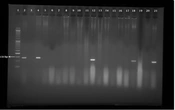 Gene Cell Tissue