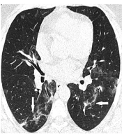 Iranian Journal of Radiology