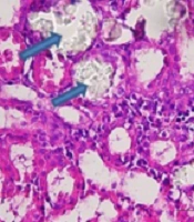 Middle East J Rehabil Health Stud