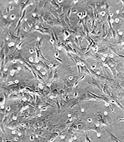  	Zahedan Journal of Research in Medical Sciences 
