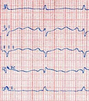 Int J Cardio Pract
