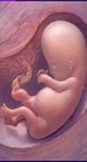 https://www.slideshare.net/mohamedsshaaban5/congenital-anomalies-ii-45012169