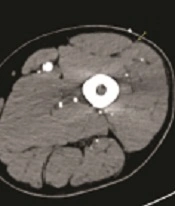 Innov J Radiol