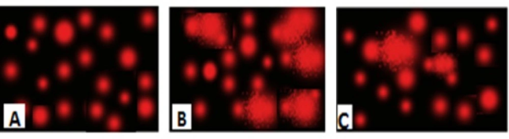 Photomicrograph represented DNA damage (Comet assay) in brain of normal rats (A), rats administered AlCl3 for 90 days(B) and rats treated with nano-HAp (C).