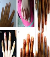 J Skin Stem Cell