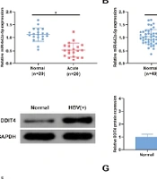 Jundishapur J Microbiol