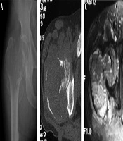 Iranian Journal of Radiology