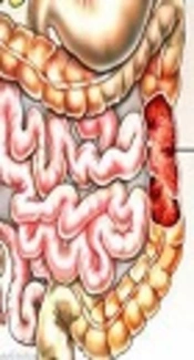 Clinical Presentation in a Series of Eight Children with Abdominal Tuberculosis: Experience of a Single-Center in Turkey