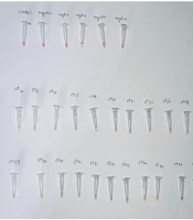 Jundishapur J Microbiol