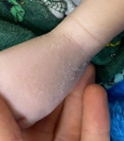 J Skin Stem Cell