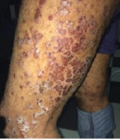J Skin Stem Cell
