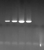 Jundishapur J Microbiol