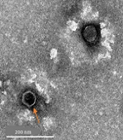 Jundishapur J Microbiol
