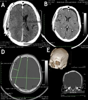 Arch Neurosci