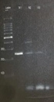 The Comparison of <i>Entamoeba gingivalis</i> Presence in Healthy and Periodontitis Patients by Using Direct Examination and PCR Methods