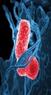 Comparative Prevalence of <i>bla</i><sub>CTX-M-15 </sub>Gene with Virulence Genes and Serotypes in <i>Klebsiella pneumoniae</i>