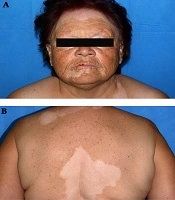 Journal of Skin and Stem Cell