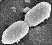 Truncated D Protein as a New Vaccine Candidate Against Nontypeable <i>Haemophilus influenza</i>