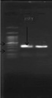 A Rare Case of Pneumococcal and Meningococcal Mixed Meningitis in an Infant with Cardiac Dysfunction