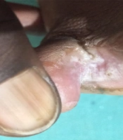 J Skin Stem Cell