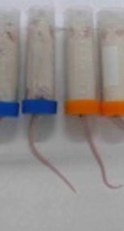 Effect of Restraint Stress on Plasma PTH Concentration and Its Molecular Targets Expressions in Wistar Rats