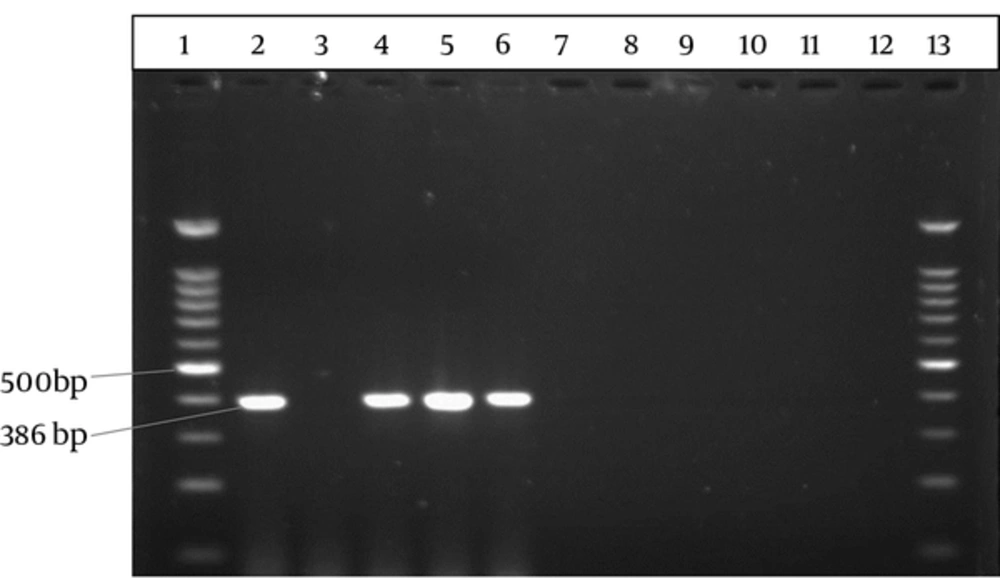 The electrophoresis of the PCR product of the <i>16S rRNA</i> gene related to <i>L. pneumophila</i> in the sputum samples Lanes 1 and 13, 100 bp DNA size marker (SinaClon BioScience Co, Iran); lane 2, positive control: <i>L. pneumophila</i> ATCC 33152; Lane 3, negative control: distilled water; lanes 4 - 6, Positive samples, and lanes 7 - 12, negative samples.