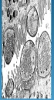 Cryptosporidium parvum, SlidePlayer