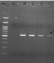Jundishapur J Microbiol