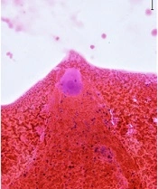 Int J Endocrinol Metab