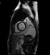 Int J Cardiovasc Pract